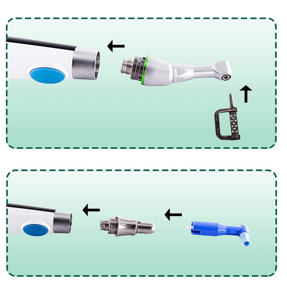 Dental Electric Wireless IPR System Orthodontic & Polishing 2-in-1 Motor